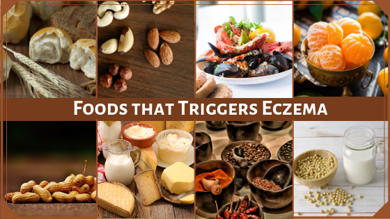 Foods to Avoid During Eczema